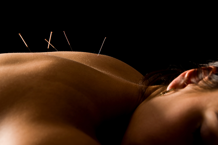 The Healing Power of Acupuncture: Benefits, Techniques, and What to Expect