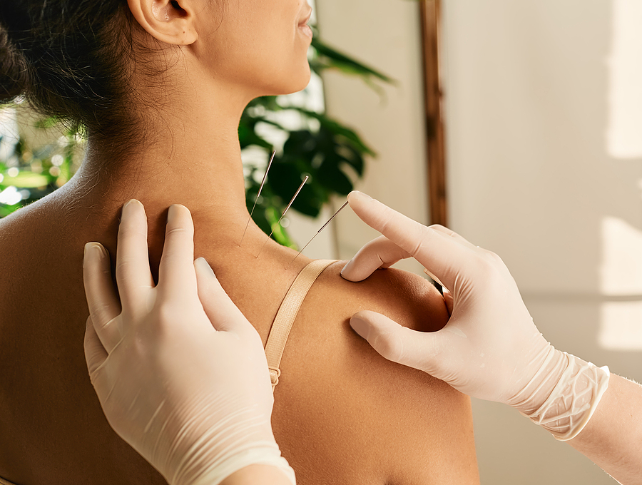 The Role of Acupuncture in Pain Management